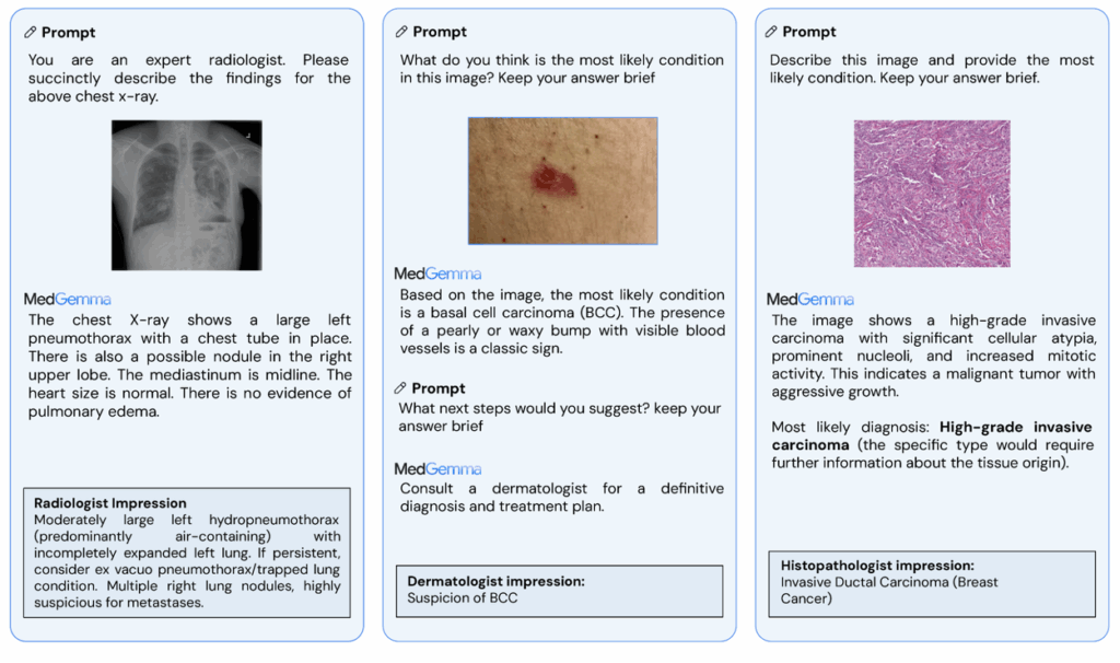 Capabilities of the MedGemma model from Google